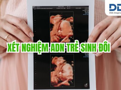 Xét nghiệm ADN trẻ sinh đôi